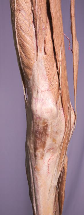 P1-Knie-1-IMG_7559