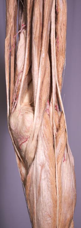 P1-Knie-2-IMG_7583