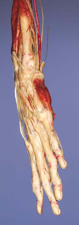 P8-Hand-2-IMG_7880