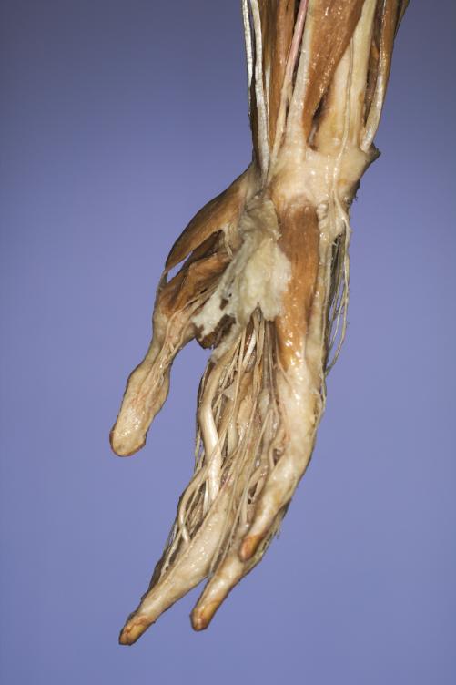 P9-Hand-5-IMG_7949