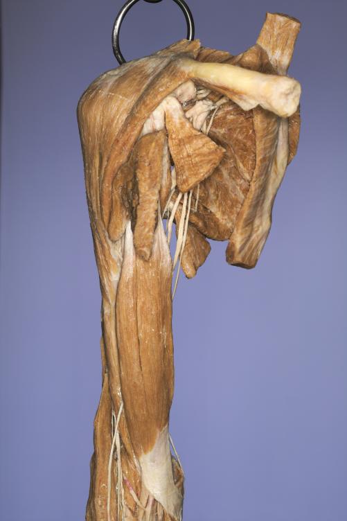 P9-Schulter-&-Oberarm-2-IMG_7922