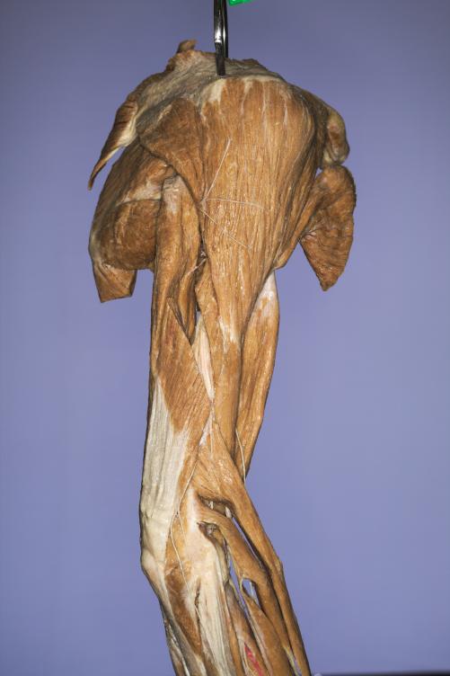 P9-Schulter-&-Oberarm-4-IMG_7939