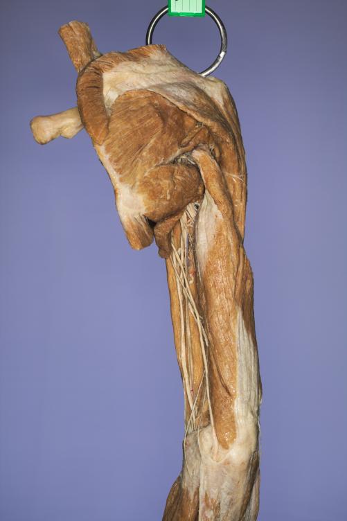 P9-Schulter-&-Oberarm-5-IMG_7947