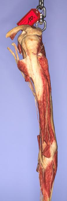 P10-Schulter-&-Oberarm-1-IMG_8405