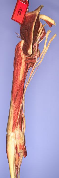 P10-Schulter-&-Oberarm-3-IMG_8427