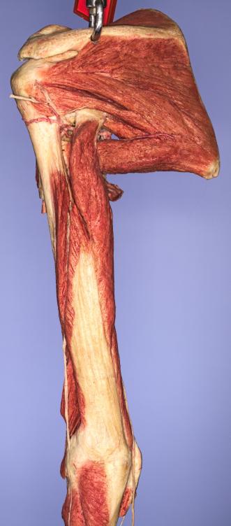 P10-Schulter-&-Oberarm-4-IMG_8434