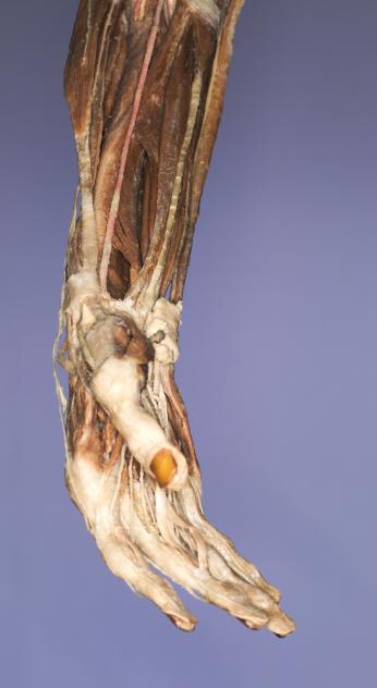 P11-Hand-2-IMG_7989