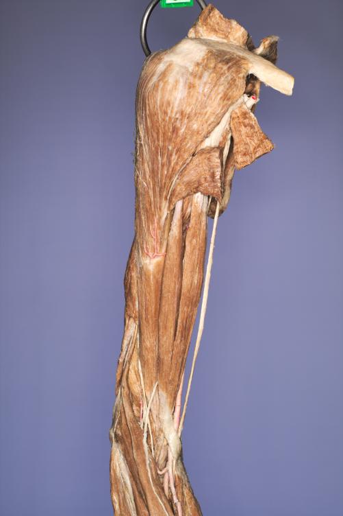 P11-Schulter-&-Oberarm-3-IMG_7995
