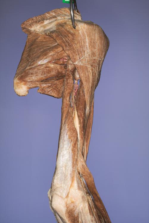 P11-Schulter-&-Oberarm-4-IMG_8004
