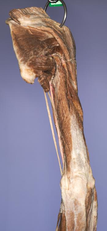 P11-Schulter-&-Oberarm-5-IMG_8014