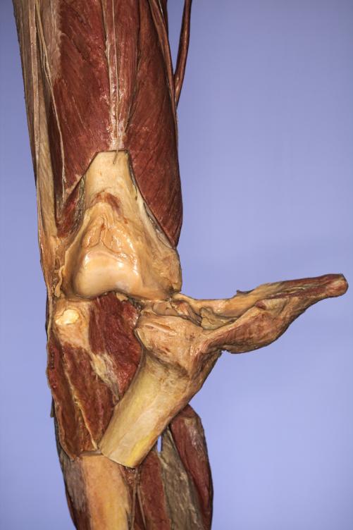 P13-Knie-1-IMG_8313