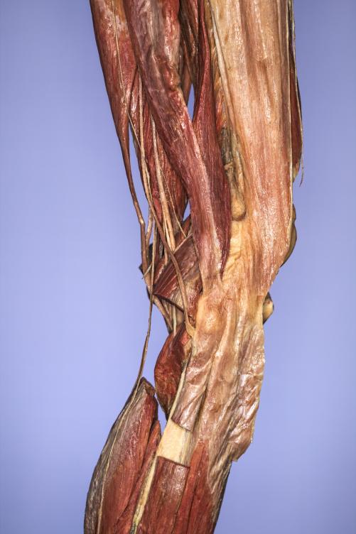 P13-Knie-4-IMG_8351