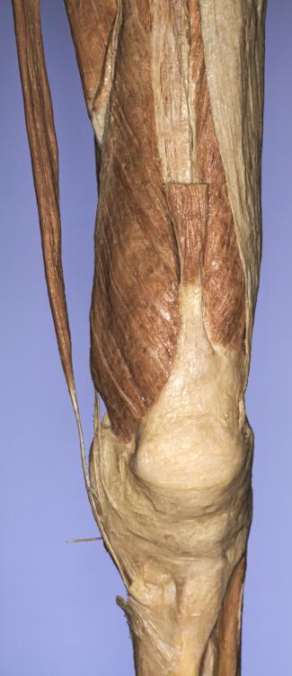 P14-Knie-1-IMG_8262