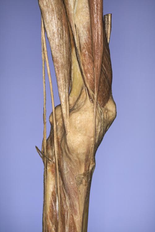 P14-Knie-2-IMG_8271