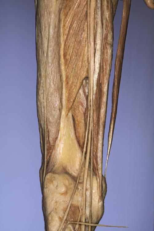 P14-Knie-3-IMG_8284