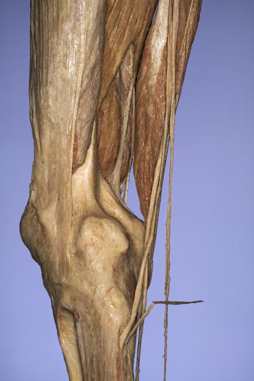 P14-Knie-4-IMG_8301