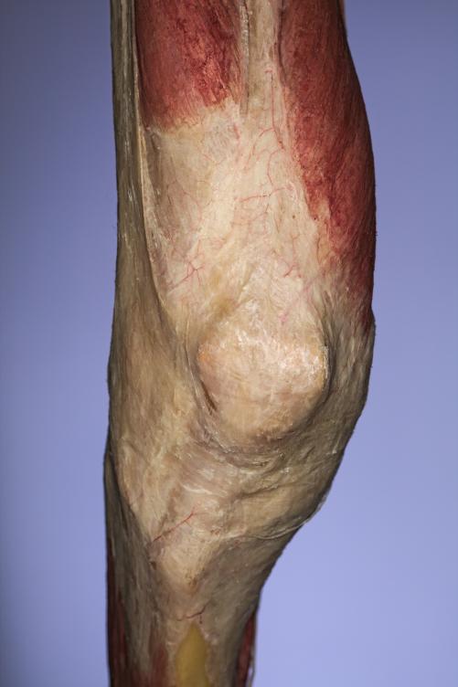 P15-Knie-1-IMG_8221