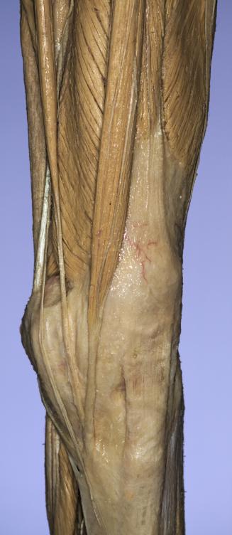 P16-Knie-1-IMG_8175