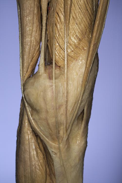 P16-Knie-2-IMG_8189