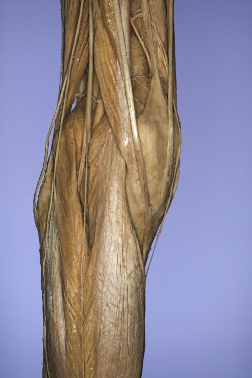 P20-Knie-2-IMG_8044